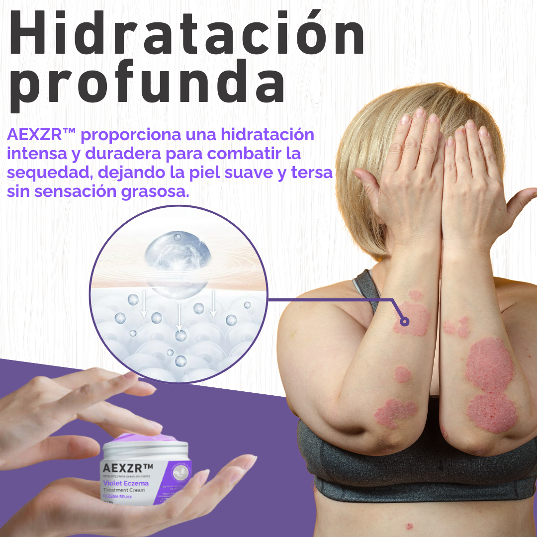 AEXZR™ Crema Violeta para el Tratamiento del Eczema