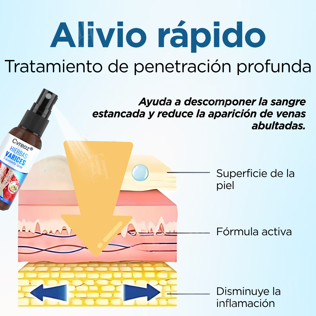 Cvreoz® Hierbas Varices Tratamiento Spray