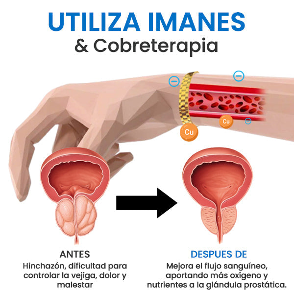 AEXZR™ Banda Magnética De Cobre Para Próstata