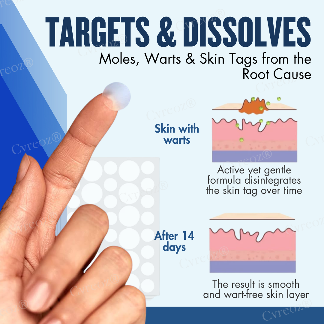 Cvreoz® Moles & Warts Removing Skin Tag Patch