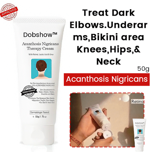 Dobshow™ Acanthosis Nigricans Hyperpigmentation Therapy Cream