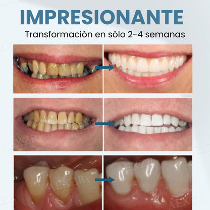 Beezau™ Polvo Restaurador Dental con Veneno de Abeja