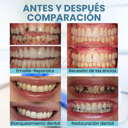 Beezau™ Polvo Restaurador Dental con Veneno de Abeja